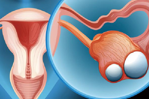 五种方法帮你远离妇科炎症