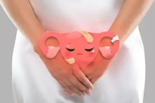 阴道炎的早期症状