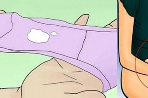 怎么判断是否有妇科炎症