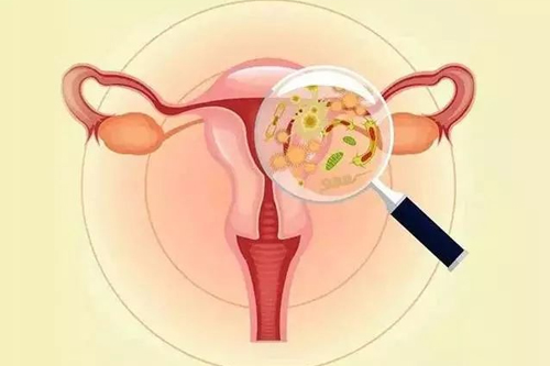 外阴炎是什么病